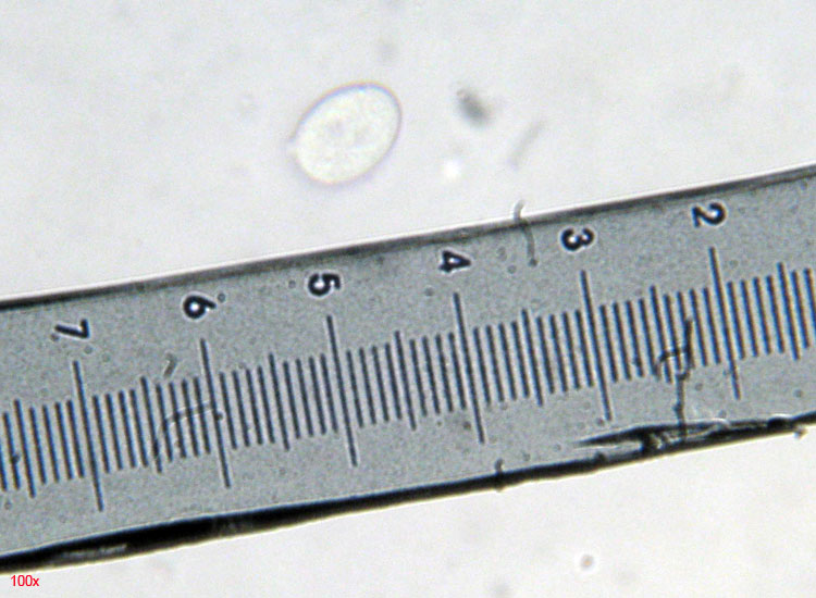Peniophora aurantiaca?